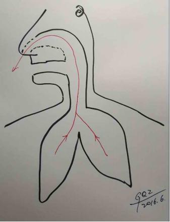 风吹流鼻涕是阳气不够吗,老是流鼻涕用什么提高抵抗力