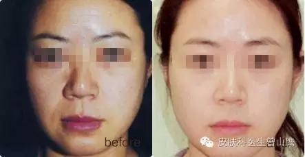 皮肤暗黄怎么办？听听专家怎么说