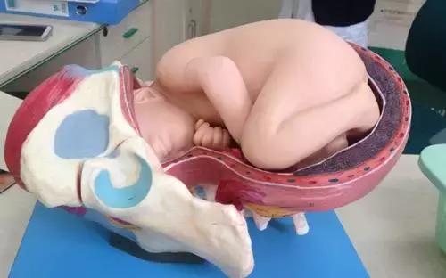 顺产开了十指才打无痛,顺产开十指以后要破羊水吗