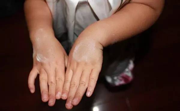 关注|强生爽身粉存致癌嫌疑在美被判天价赔偿夏天来了爽身粉还能用吗？