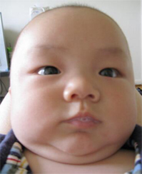 孩子口吐白沫翻白眼怎么办,孩子口吐白沫怎么急救