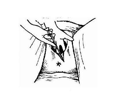 产后顺产妈妈要关注什么问题,侧切妈妈怎么恢复