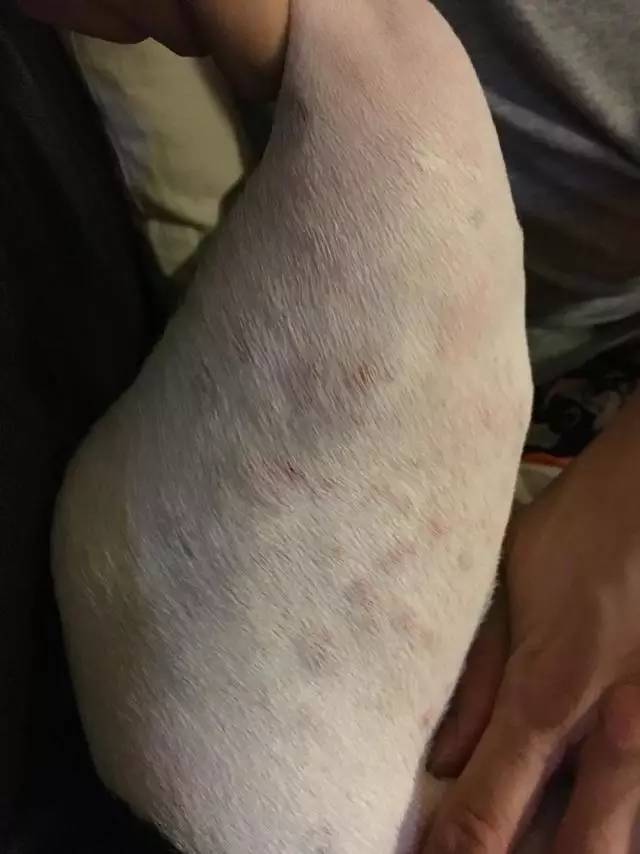 激萌祛痘了怎么恢复,激萌正确使用法