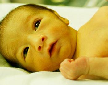 治疗新生儿黄疸最有效的办法,新生儿黄疸怎么造成的