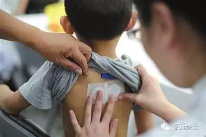 招远最强“三伏贴”攻略来啦！拿走不谢！