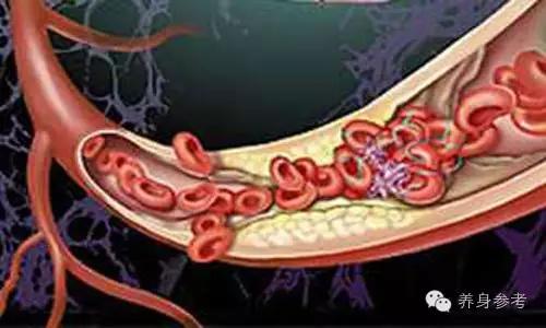 心脑血管疾病保命指南,普及心脑血管疾病的营养与膳食