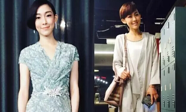 她们“肿”了，都是因为苹果肌惹的祸！