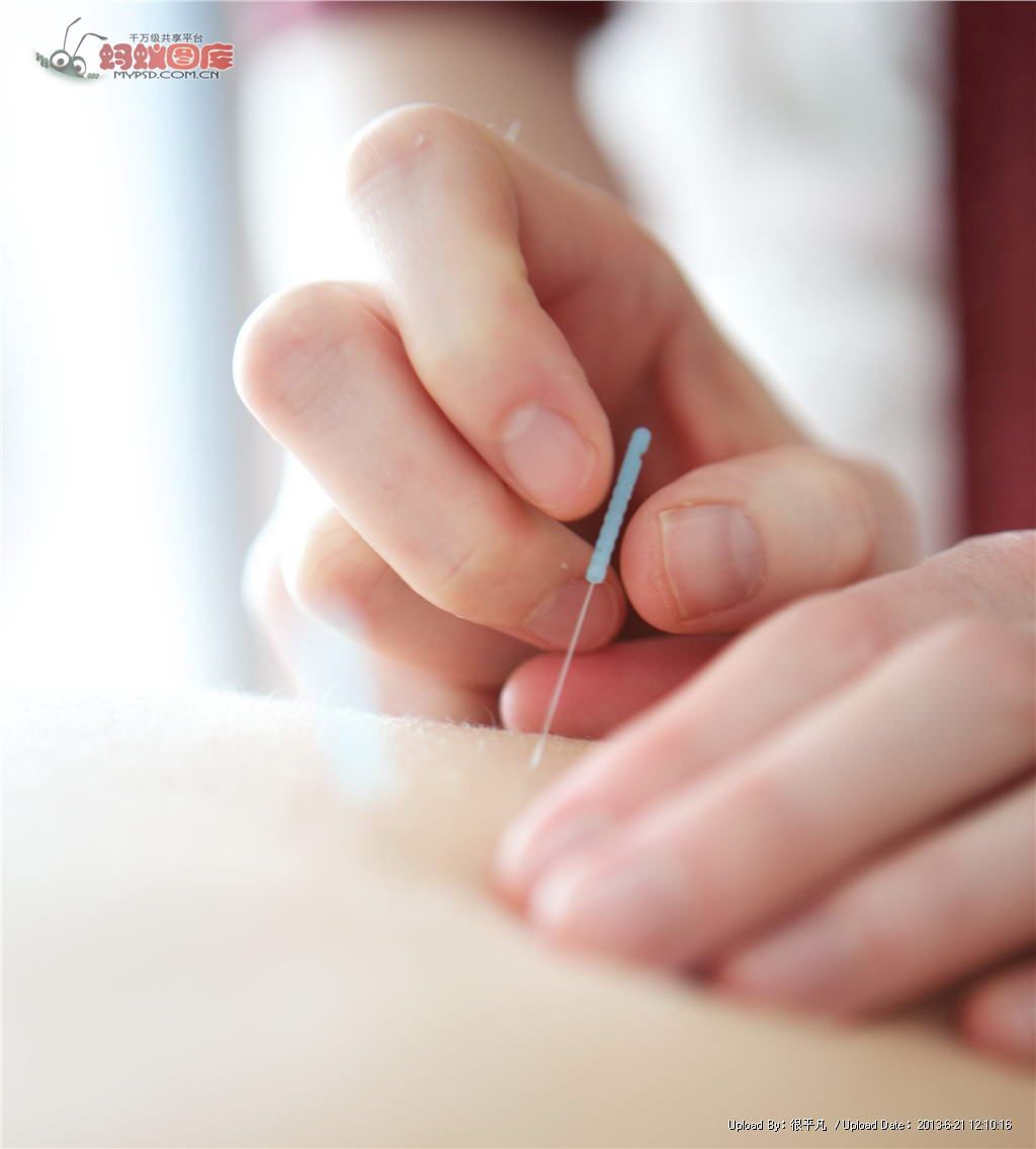 医院针灸一次收费3800元合理么,针灸一次多少钱费用合理