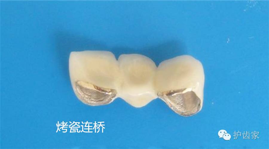 医生，我不小心把烤瓷牙吃到肚子里了！咋办啊！