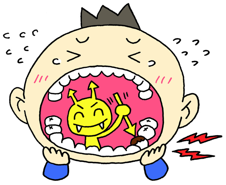 早期蛀牙怎么用药,食物嵌塞蛀牙平时如何维护