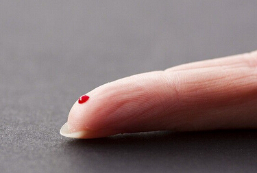 抽血导致皮下渗血怎么办,抽血后皮下淤血怎么处理