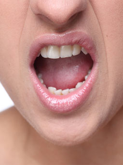 接吻会传染口腔溃疡？其实还有其他疾病