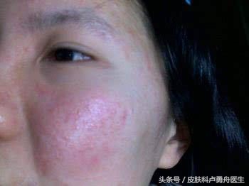 直播间关于面子的话题,直播面子问题