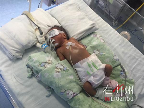 28周早产儿呼吸一直不太好要紧吗,28周早产儿呼吸暂停19次严重