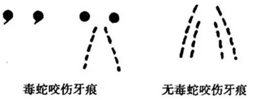 被蛇咬了怎么包扎,救命贴正确方法