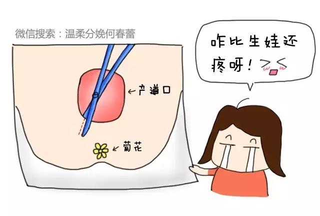 都什么年代了，还有常规侧切？