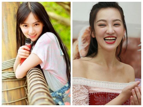 她们“肿”了，都是因为苹果肌惹的祸！