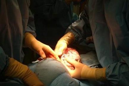 剖腹产的妈妈有多伟大,剖腹产的妈妈最伟大