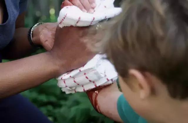 孩子磕碰家长正确处理方式,宝宝老是磕磕碰碰受伤怎么办