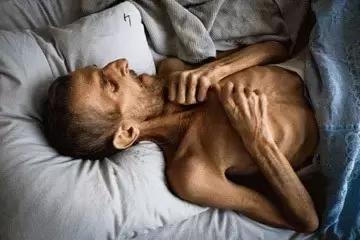 中医药预防肺结核病复发