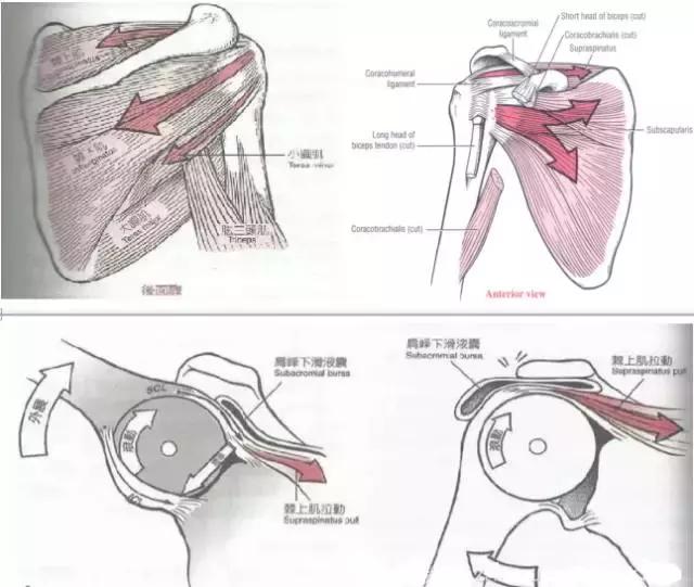 肩部撞击症,肩部撞击怎么康复