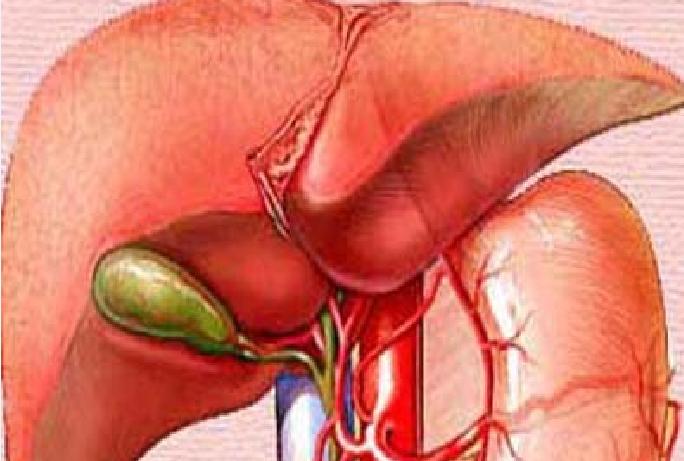 胆结石有没有必要保胆,17岁胆结石手术保胆好还是切除好