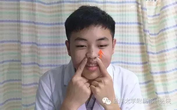 吹空调避免面瘫小技巧,吹空调面瘫嘴歪怎么治疗