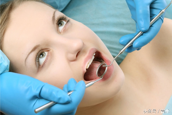 牙齿去渍美白小妙招,妙招姐的牙齿美白生活小妙招视频