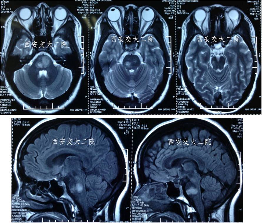 介入科病例,介入手术的健康科普方案