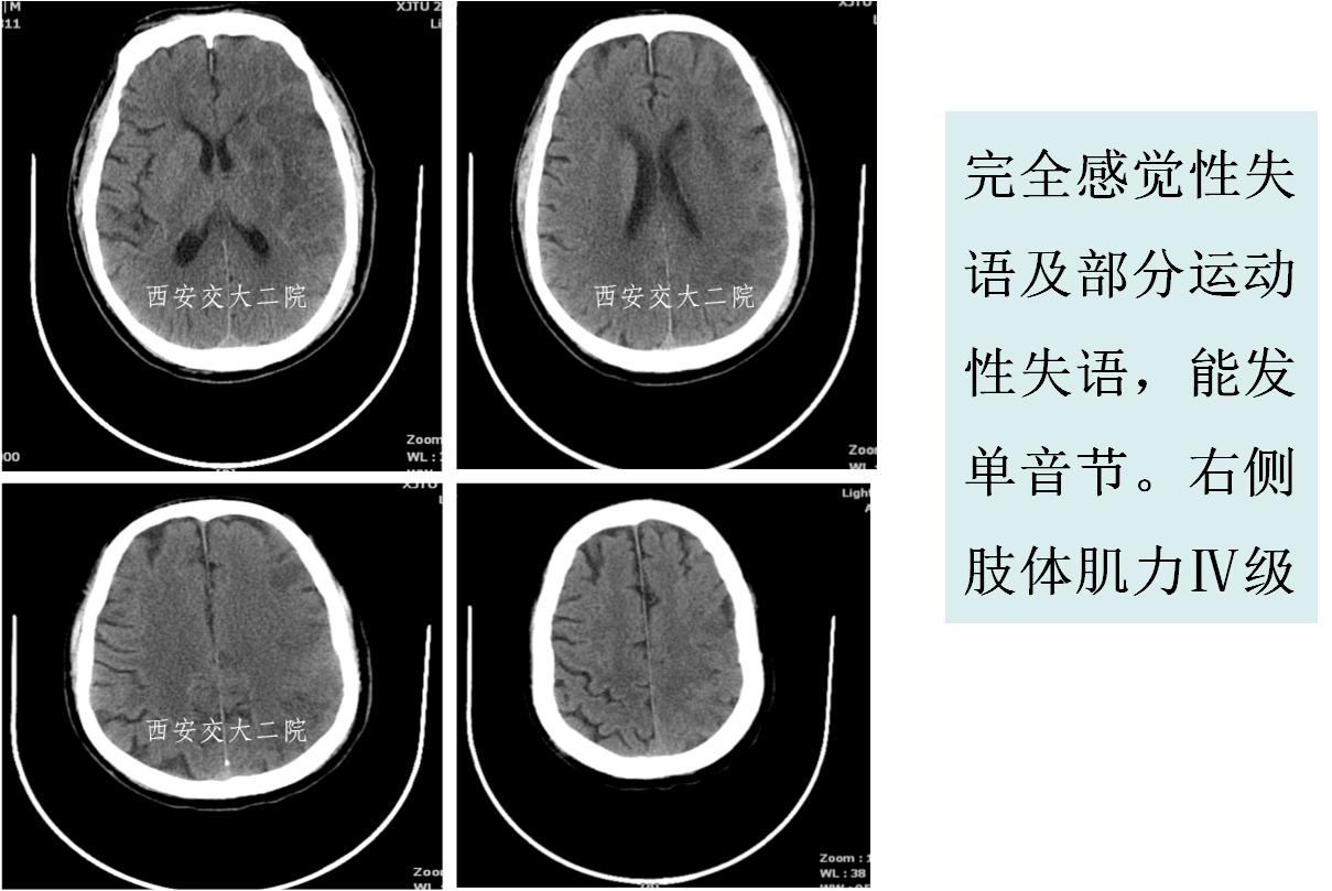 介入科病例,介入手术的健康科普方案