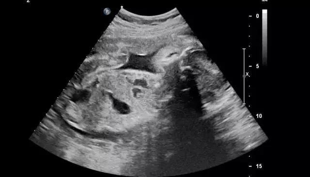 怀胎三月：大家都来生孩子