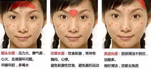 长痘尽量不吃什么,长痘尽量不要吃海鲜