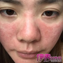 面膜被查,面膜要警惕哪种添加剂