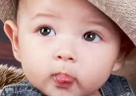 孩子嘴馋咬舌头了怎么办,宝宝咬到舌头吃什么