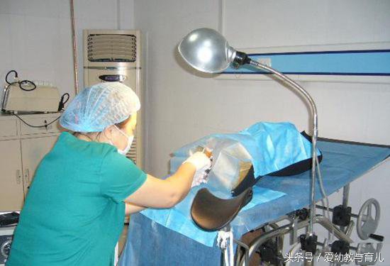 单亲孕妈流产,35宝妈四次剖腹产的经历