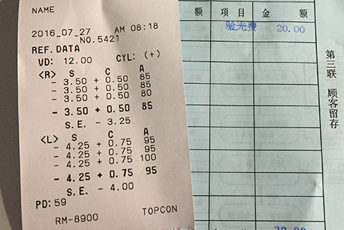 散光是怎么回事有了散光该怎么办,散光怎么引起的原因