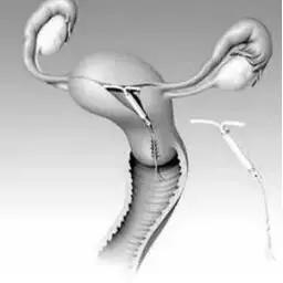 围绝经期异常子宫出血的治疗首选,女性异常子宫出血的护理问题