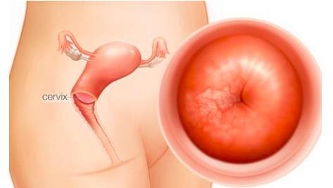 预约宫颈癌疫苗是怎么预约,关于宫颈癌疫苗的知识文章