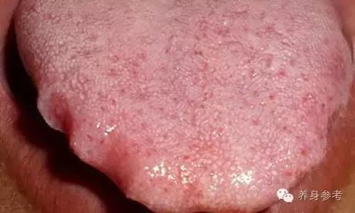 大暑祛湿的穴位图解,湿热如何降暑