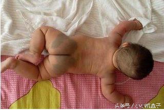 六个月宝宝左右手臂里面有硬块,宝宝手臂里有个硬块摸得到看不到