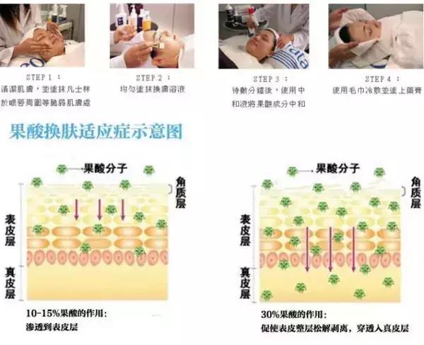 长痘尽量不吃什么,长痘尽量不要吃海鲜