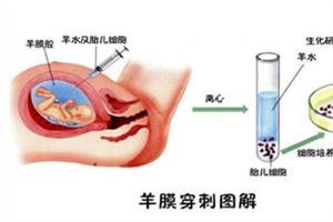 NT增厚4.3mm顺利过关5点经验总结奉献给孕妈咪们！