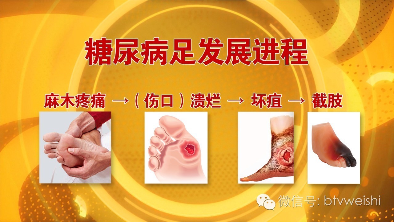 养生堂今天的直播回放,养生堂今日现场直播回放