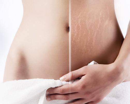 维生素e软胶囊对头发有什么功效,维生素E对皮肤有什么好处