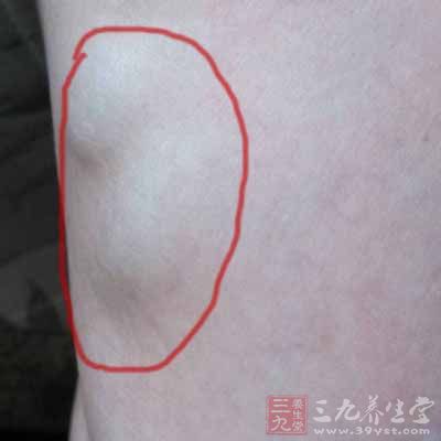 淤血硬块揉开像水一样,淤血处摸起来有结块