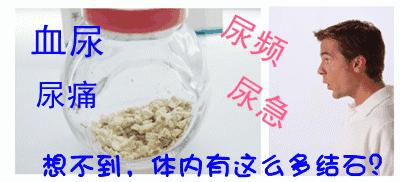 夏天，别让您的“下水道”总长石头