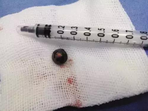 流浪狗被箭射穿违法吗,流浪狗被箭射穿