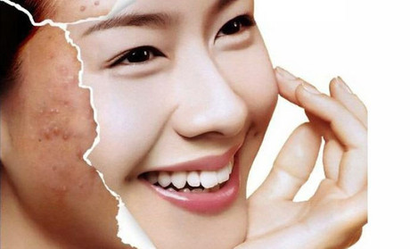 可以吃内服外用的的珍珠粉,珍珠粉祛痘原理