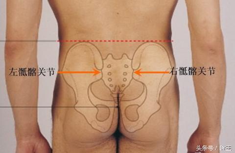 盆骨不等高怎样矫正,骨盆不稳定怎么治