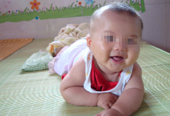 2岁男童少了一个蛋蛋，宝妈惊慌不知所措